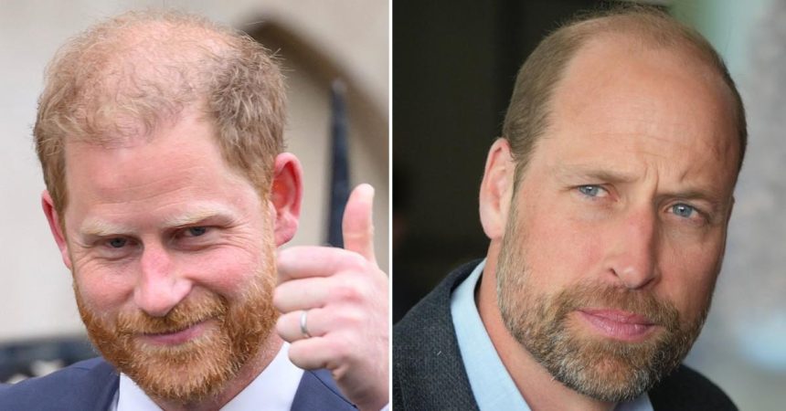 Prince Harry Admits He’s Going Bald After Mocking Brother’s Lack of Hair