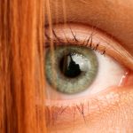 Red Hair Gene Could Explain Why Some Wounds Never Heal : ScienceAlert