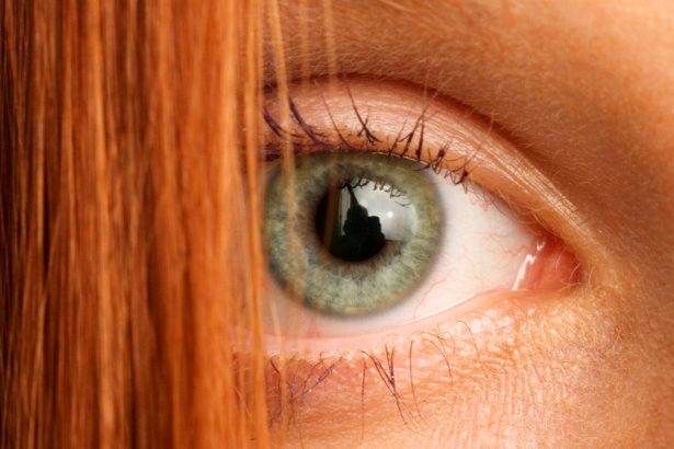 Red Hair Gene Could Explain Why Some Wounds Never Heal : ScienceAlert