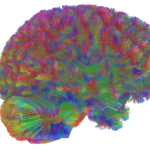 Scientists Identify Five Distinct Eras of Human Brain Aging