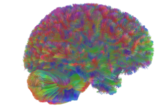 Scientists Identify Five Distinct Eras of Human Brain Aging