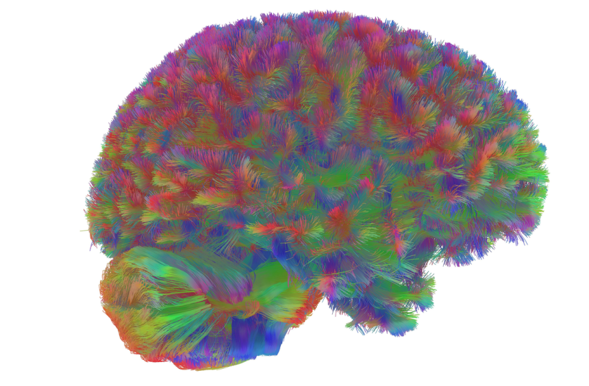 Scientists Identify Five Distinct Eras of Human Brain Aging