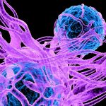 Serotonin Could Play an Unexpected Role in Cancer, Scientists Discover : ScienceAlert