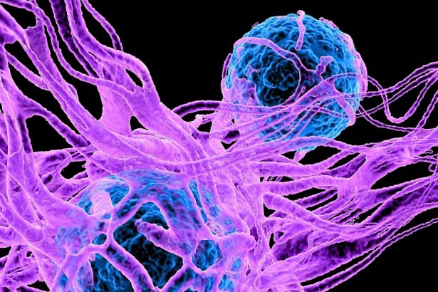Serotonin Could Play an Unexpected Role in Cancer, Scientists Discover : ScienceAlert