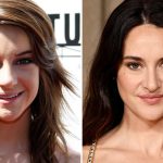Shailene Woodley — Good Genes or Good Docs?!