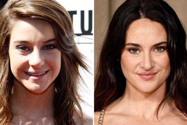 Shailene Woodley — Good Genes or Good Docs?!