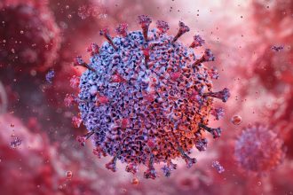The Epstein-Barr Virus May Cause Lupus