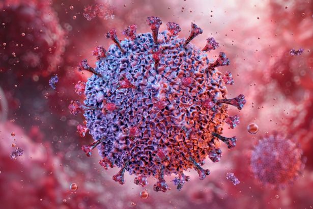 The Epstein-Barr Virus May Cause Lupus