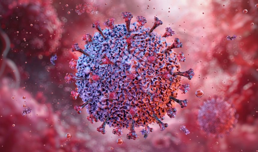 The Epstein-Barr Virus May Cause Lupus