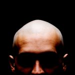 This Drug Is Effective For Male Hair Loss, But The Side Effects Can Be Serious : ScienceAlert