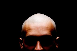 This Drug Is Effective For Male Hair Loss, But The Side Effects Can Be Serious : ScienceAlert