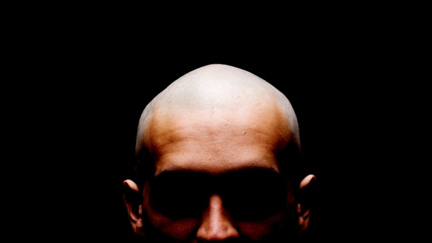 This Drug Is Effective For Male Hair Loss, But The Side Effects Can Be Serious : ScienceAlert