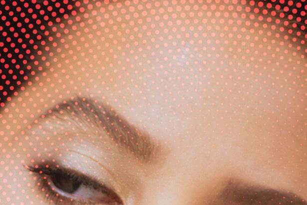 Everything to Know About At-Home Microneedling