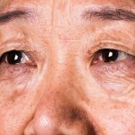 Your Vision Can Predict Dementia 12 Years Before a Diagnosis, Research Suggests : ScienceAlert