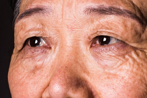 Your Vision Can Predict Dementia 12 Years Before a Diagnosis, Research Suggests : ScienceAlert