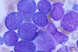 At ASH, positive news for Terns, Kura leukemia treatments