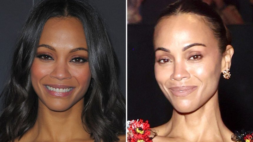 ‘Avatar’ Queen Zoe Saldana Good Genes or Good Docs?!