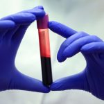 Blood of Exceptionally Long-Lived People Reveals Crucial Differences : ScienceAlert