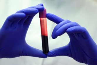 Blood of Exceptionally Long-Lived People Reveals Crucial Differences : ScienceAlert