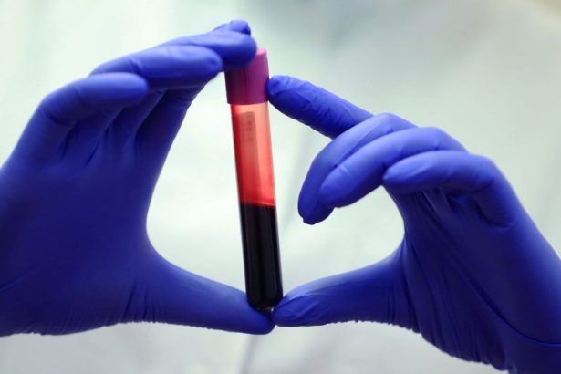 Blood of Exceptionally Long-Lived People Reveals Crucial Differences : ScienceAlert