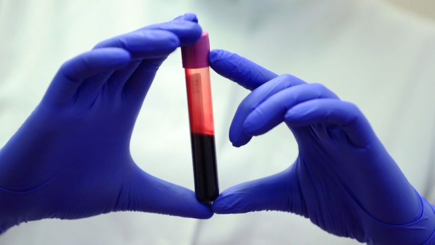 Blood of Exceptionally Long-Lived People Reveals Crucial Differences : ScienceAlert