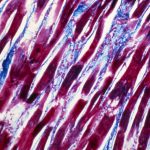 Cause of very rare Covid vaccine side effect, myocarditis, identified