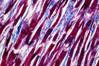 Cause of very rare Covid vaccine side effect, myocarditis, identified