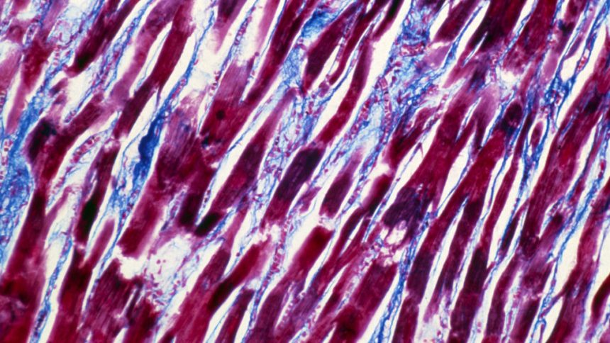 Cause of very rare Covid vaccine side effect, myocarditis, identified