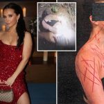 Ex-NJ GOP aide ordered to get mental help after allegedly brutalizing herself in fake anti-Trump attack