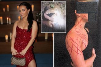 Ex-NJ GOP aide ordered to get mental help after allegedly brutalizing herself in fake anti-Trump attack