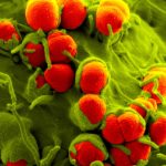 FDA approves Nuzolvence, new pill for gonorrhea