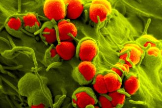 FDA approves Nuzolvence, new pill for gonorrhea