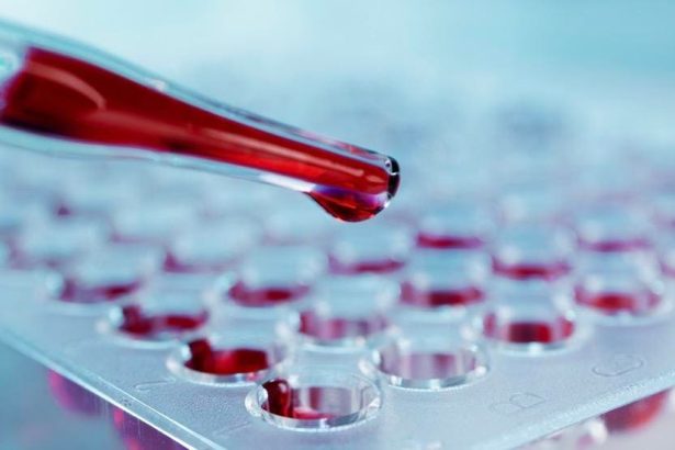 Flipping The Switch And Turning On New Sickle Cell And Thalassemia Therapies