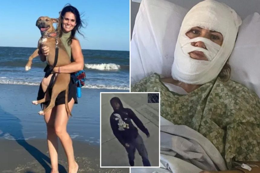 Georgia woman Ashley Wasielewski suffered severe burns after being doused with toxic chemical in random park attack