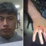 Illegal immigrant bites ICE officer, draws blood while resisting arrest in Tullos, Louisiana