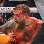 Jake Paul in Hospital with ‘Double Broken Jaw’ After Losing Netflix Fight