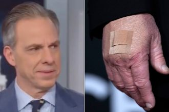 Jake Tapper Rejects White House Reason For Trump’s Bruises: ‘There Is Something Going On’
