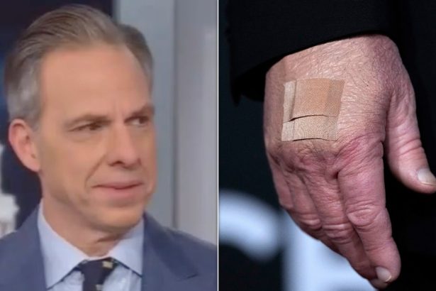 Jake Tapper Rejects White House Reason For Trump’s Bruises: ‘There Is Something Going On’