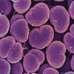 Lancet study shows new antibiotic effective against gonorrhea