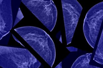 Mammograms, gonorrhea, gen AI: Morning Rounds