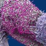 Man unexpectedly cured of HIV after stem cell transplant