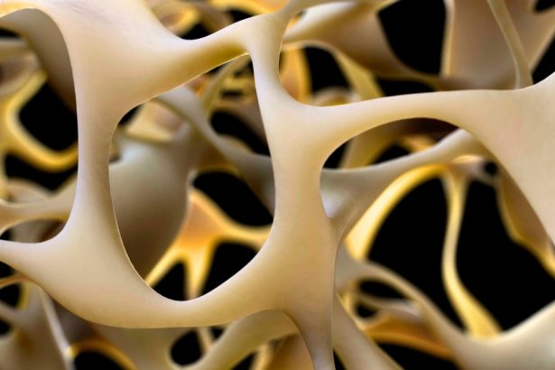 New Breakthrough to Strengthen Bone Could Reverse Osteoporosis : ScienceAlert