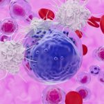 New Cancer Therapy Offers Hope For ‘Incurable’ Leukaemia in Early Trial : ScienceAlert