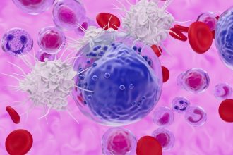 New Cancer Therapy Offers Hope For ‘Incurable’ Leukaemia in Early Trial : ScienceAlert