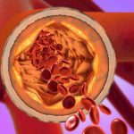 One Protein Is a Better Predictor of Heart Disease Than Cholesterol : ScienceAlert