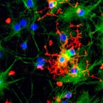 Prion-Like Brain Damage Can Occur Without Infectious Prions, Study Finds : ScienceAlert