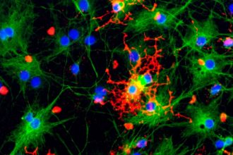 Prion-Like Brain Damage Can Occur Without Infectious Prions, Study Finds : ScienceAlert