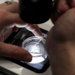 Sperm donor with rare cancer-causing mutation fathers nearly 200 children