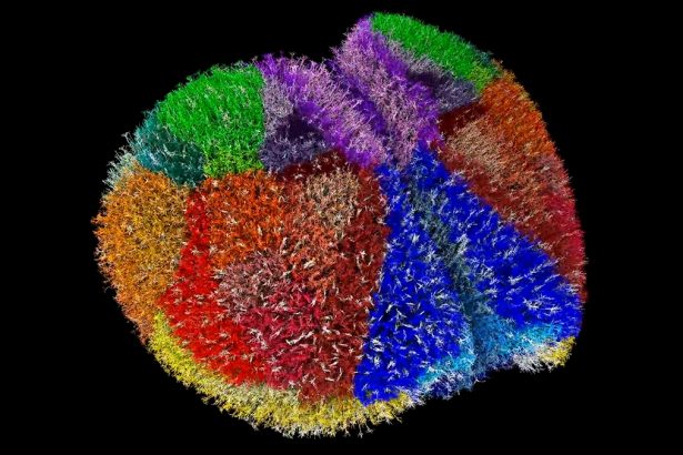 Supercomputer Creates One of The Most Realistic Virtual Brains Ever Seen : ScienceAlert