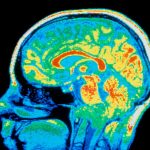 Supposedly distinct psychiatric conditions may have same root causes